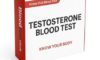 Testosterone Blood Test: Key Facts for Birmingham Locals