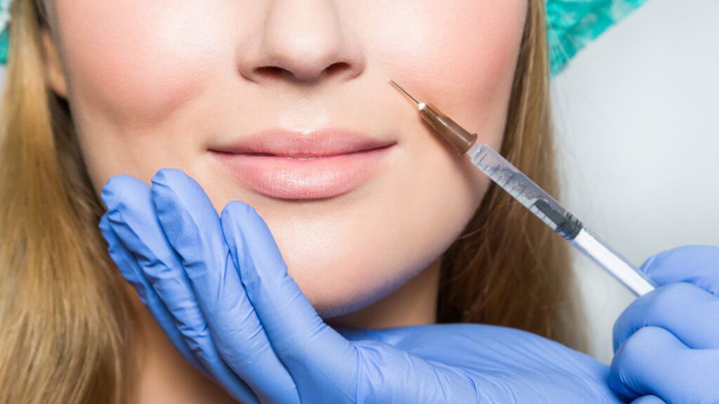 Lip Filler Simulation for Your Ideal Aesthetic Vision!